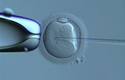 Three-parent embryos: 5 big questions MPs failed to answer