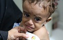 Yemen, the worst humanitarian crisis of the world