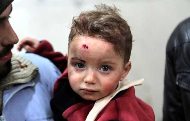 An injured child is seen in a field hospital, near Damascus  / Reuters, Badra Mamet),child, ISIS, Irak